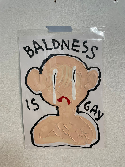 BALDNESS IS GAY