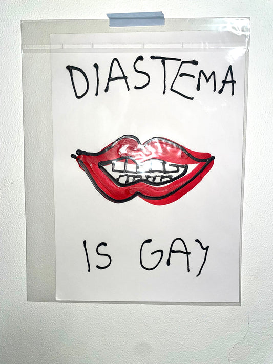 DIASTEMA IS GAY